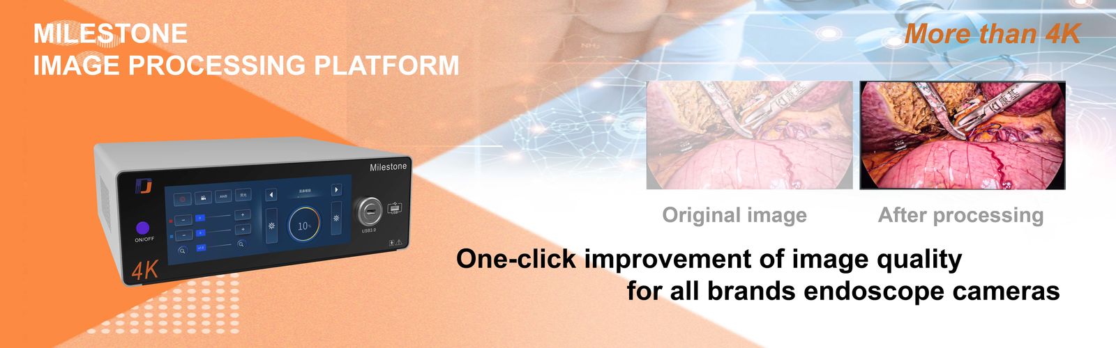 মেডিকেল এন্ডোস্কোপ ক্যামেরা